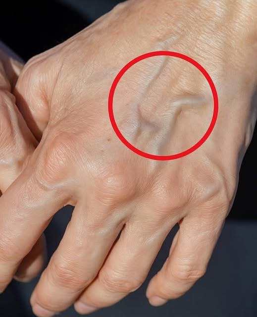 Why are your veins suddenly bulging and visible?