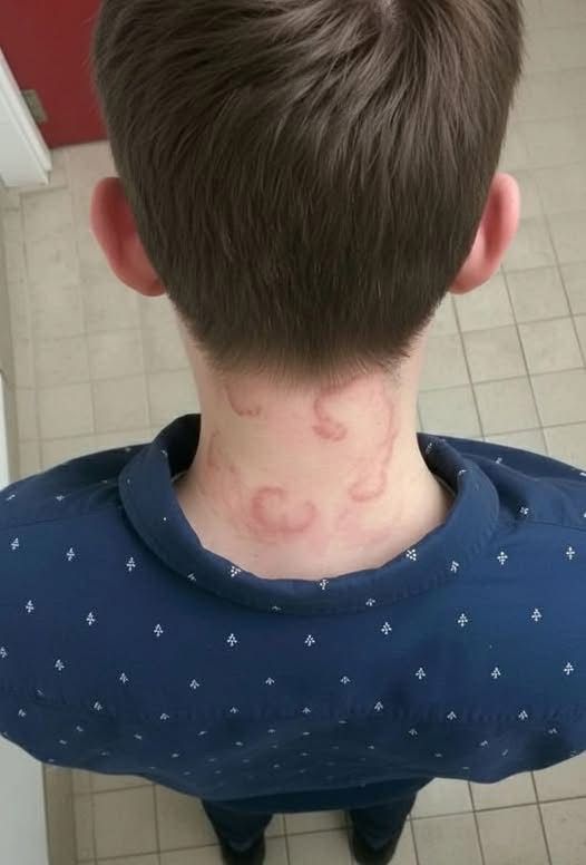 My 8 year old son been having this for 2 months straight it’s gotten worse