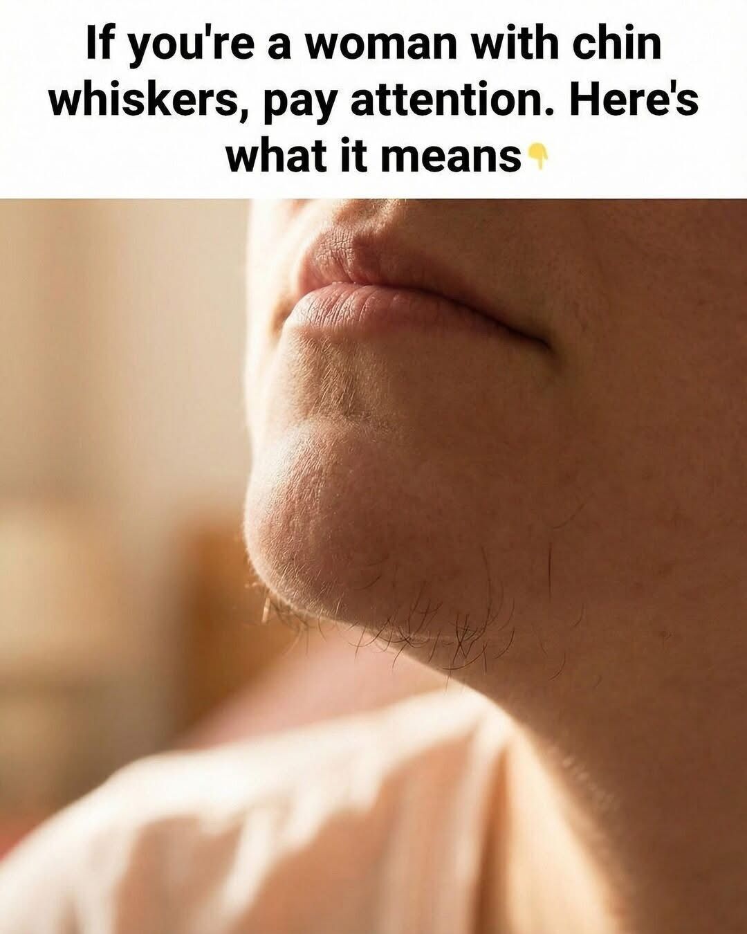 If You Are a Woman, What Your Chin Whiskers Could Quietly Be Telling You About Your Hormones, Metabolism, Stress Levels, and Overall Health — Signs Many Ignore Until Other Symptoms Appear