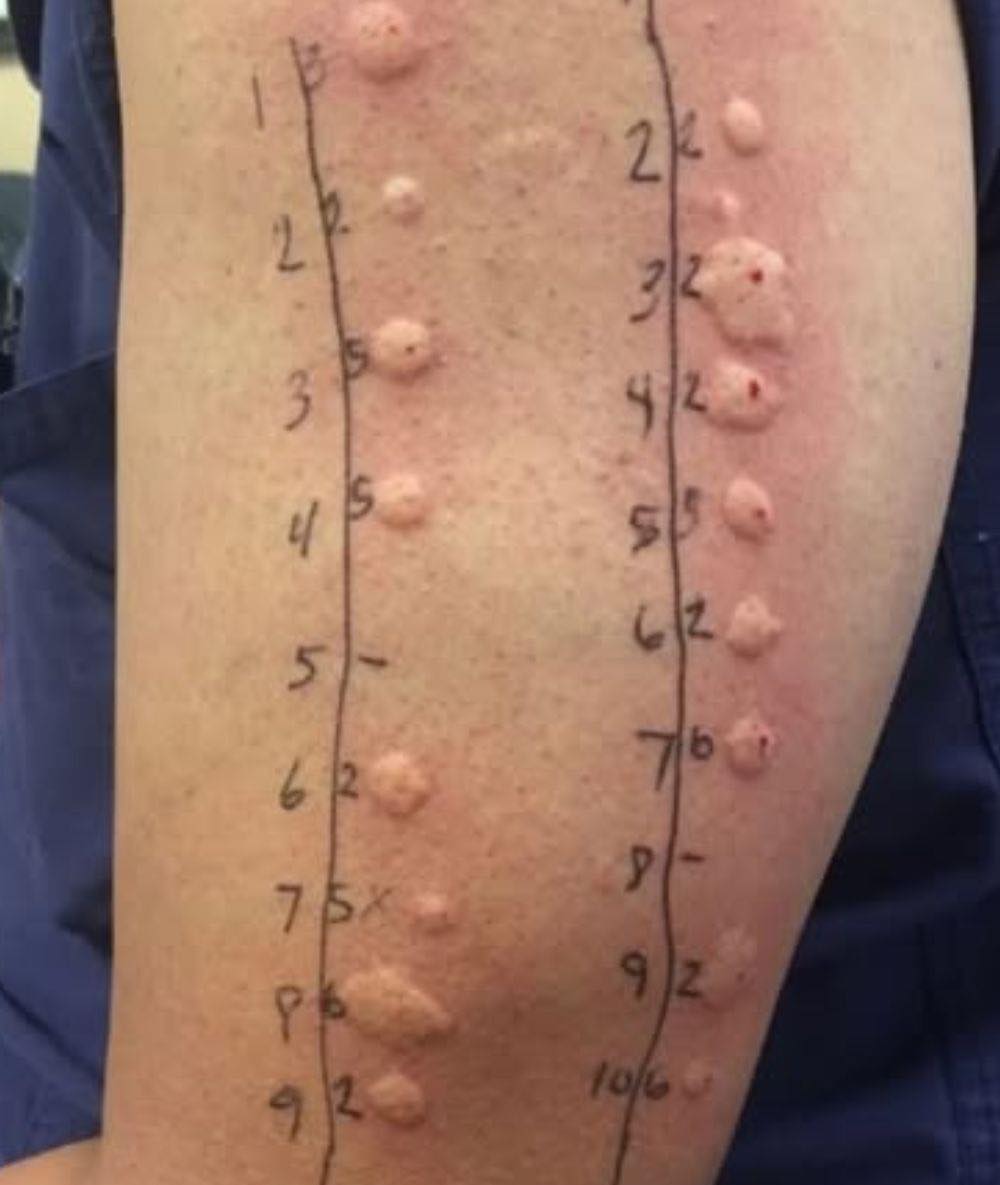 What Happens When You Sleep Too Cold