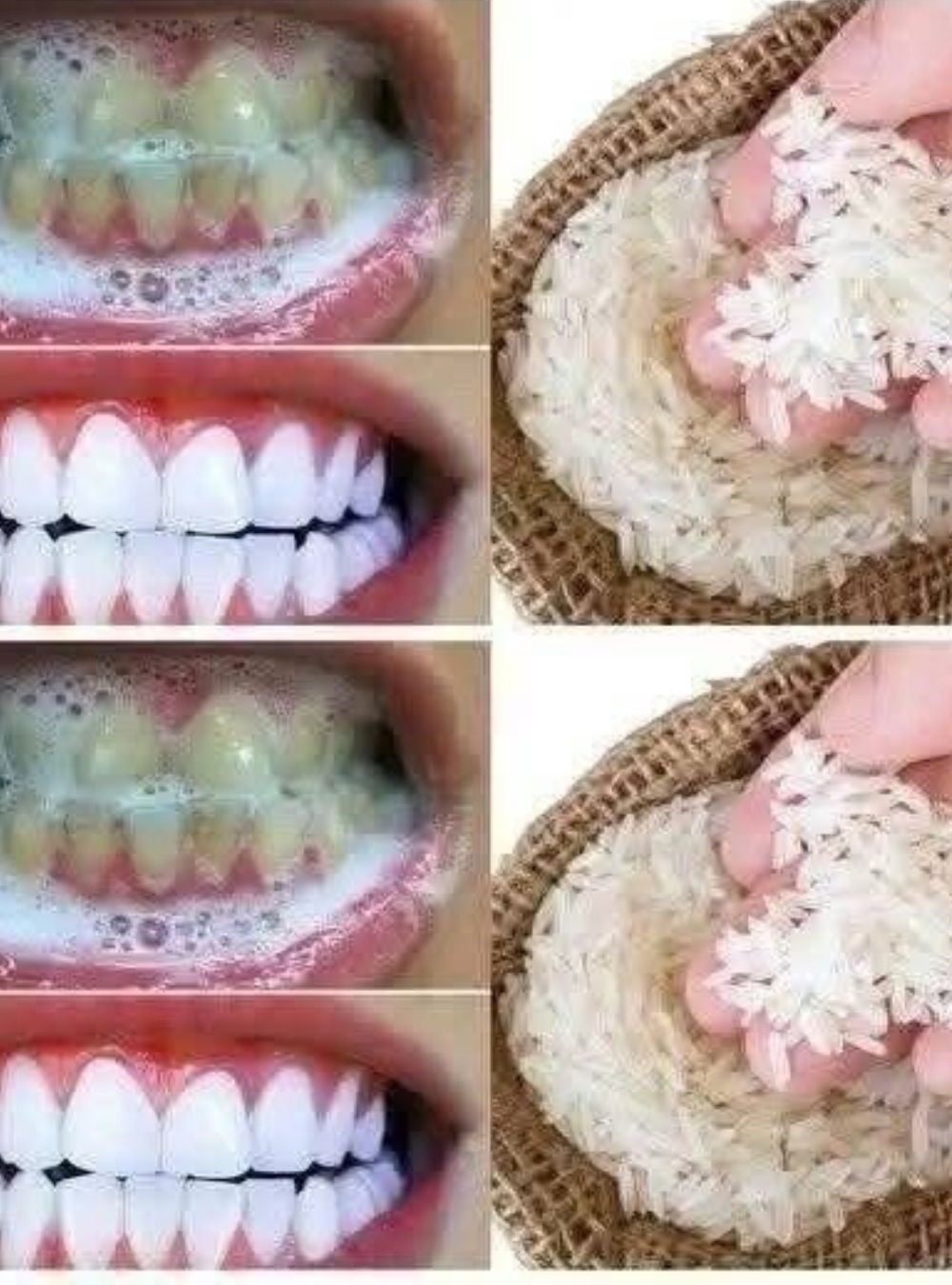 A “1-Minute Teeth Whitening Trick” You Should Think Twice About