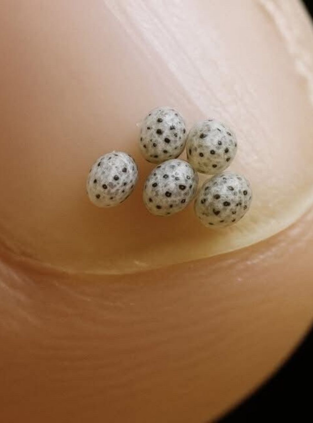 We Ordered a Salad — Then Noticed Tiny Black Specks and Rushed to the Hospital