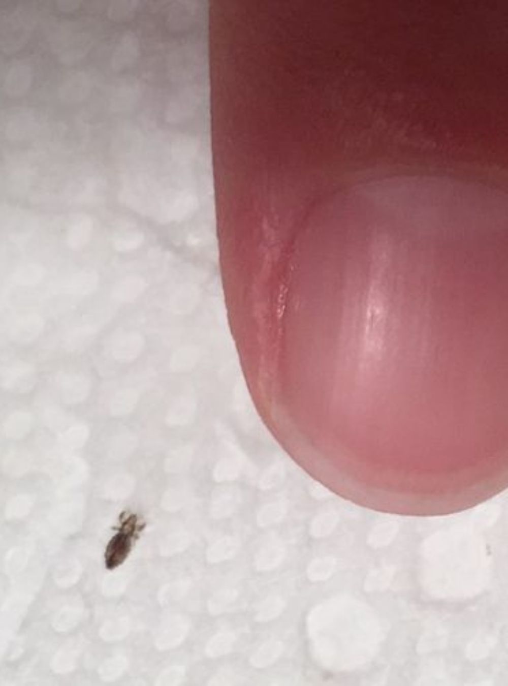 Found an Insect in Your Hair? Safe and Effective Ways to Remove It